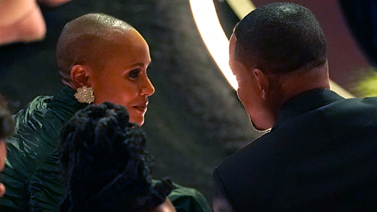 What is alopecia areata? Why Chris Rock's joke about Jada Pinkett Smith struck a nerve