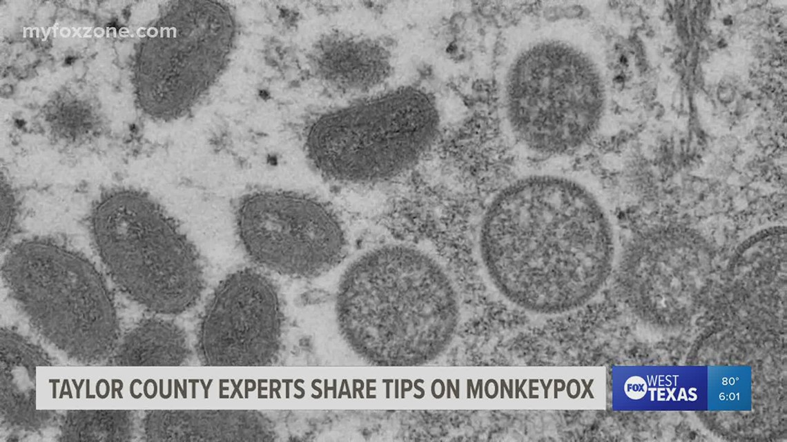 After Taylor County confirms first monkeypox case, health experts give tips on prevention