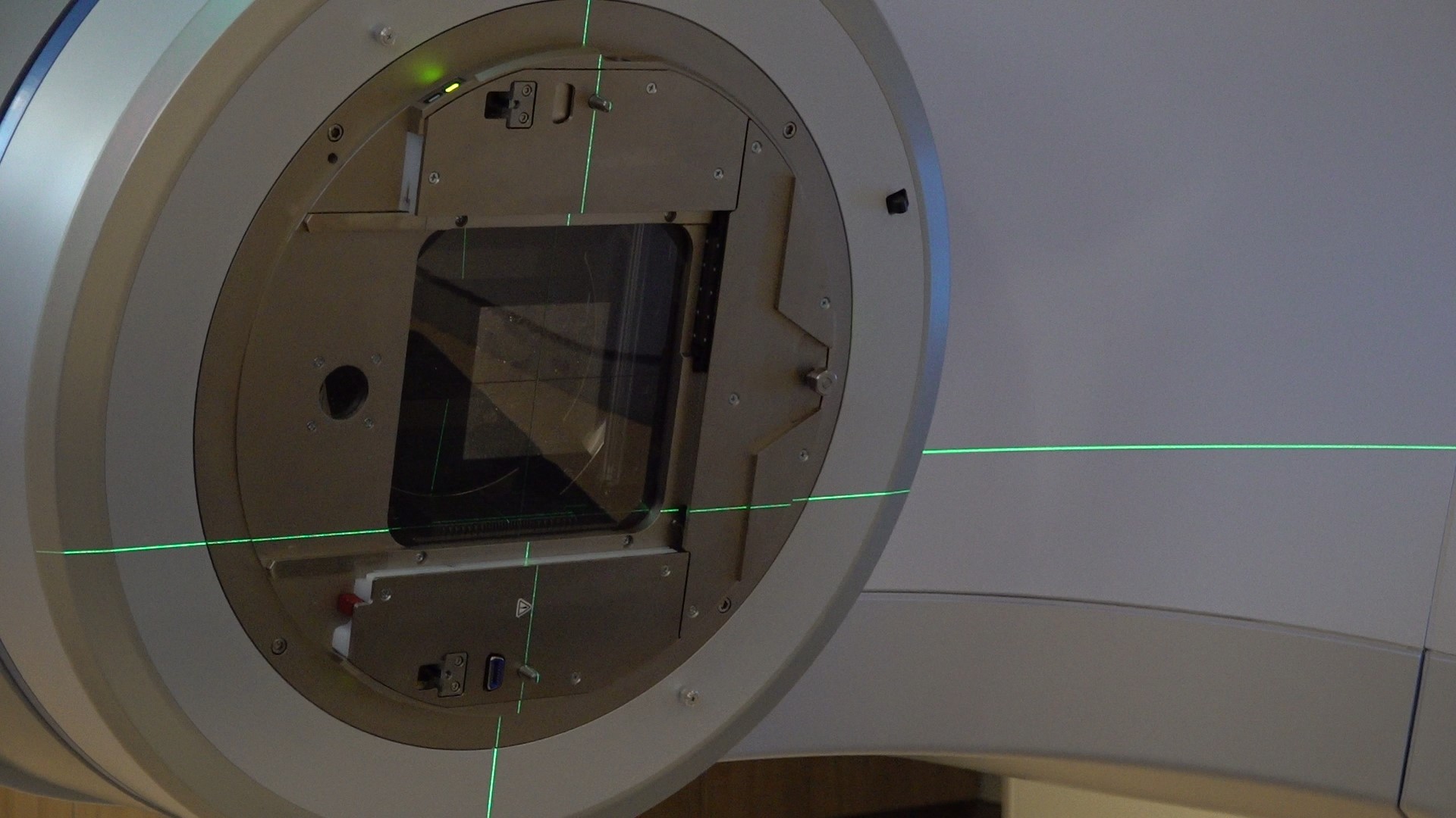 Surface guided radiation therapy uses infrared cameras to provide a more precise form of treatment that does not require permanent markings.