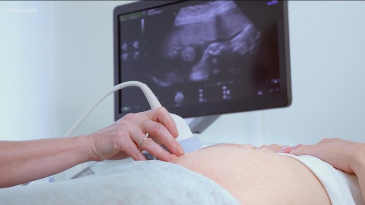 Texas lawmakers, advocates push for more data on pregnancy and childbirth complications