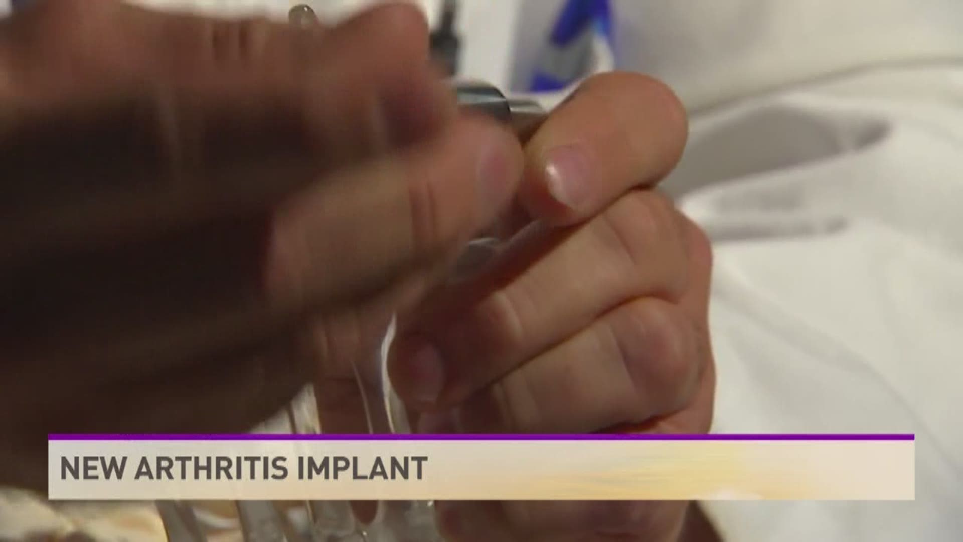 There's a promising new treatment for those suffering from big toe arthritis.