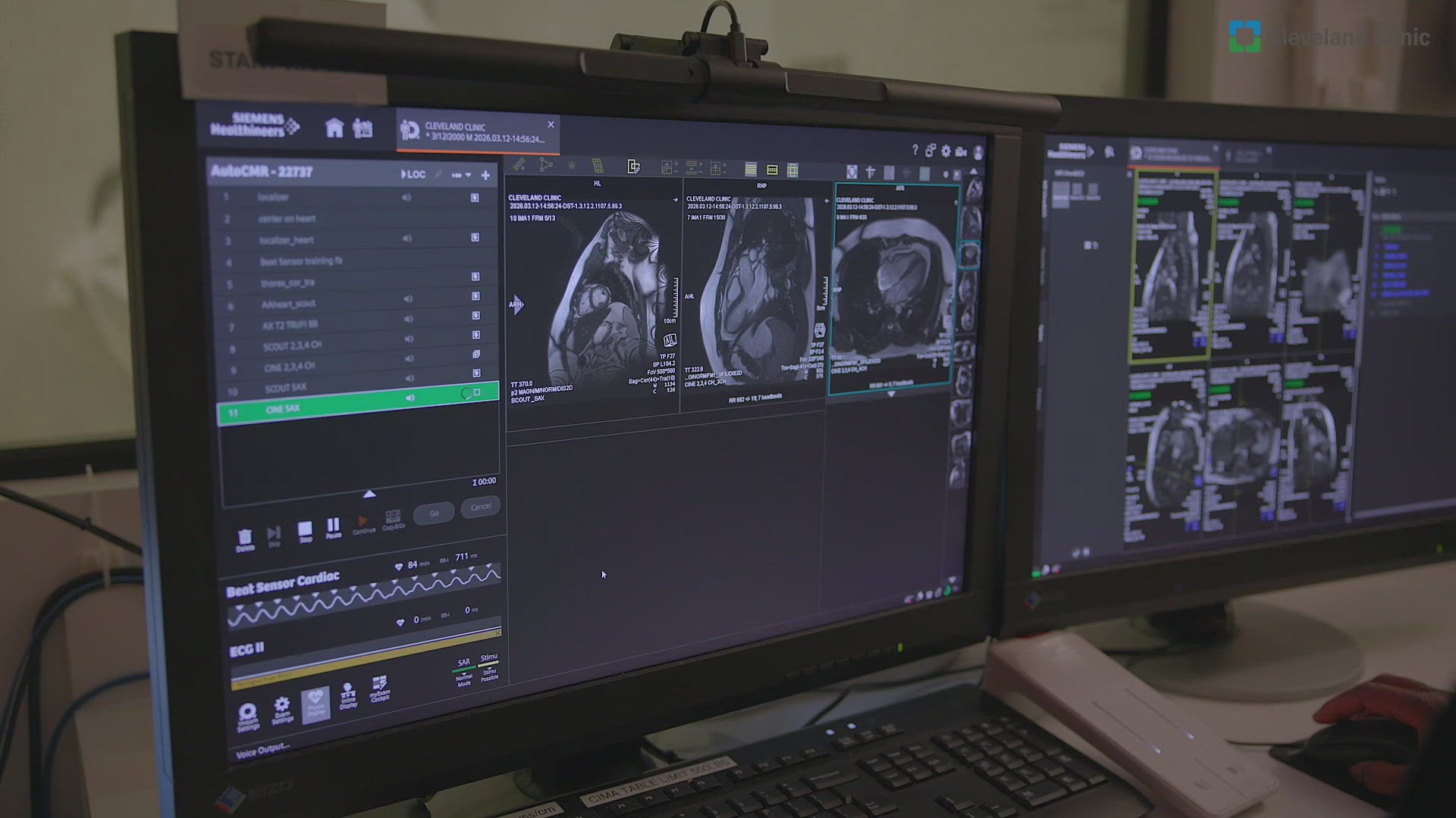AI technology revolutionizes heart scan interpretation with 99% ...