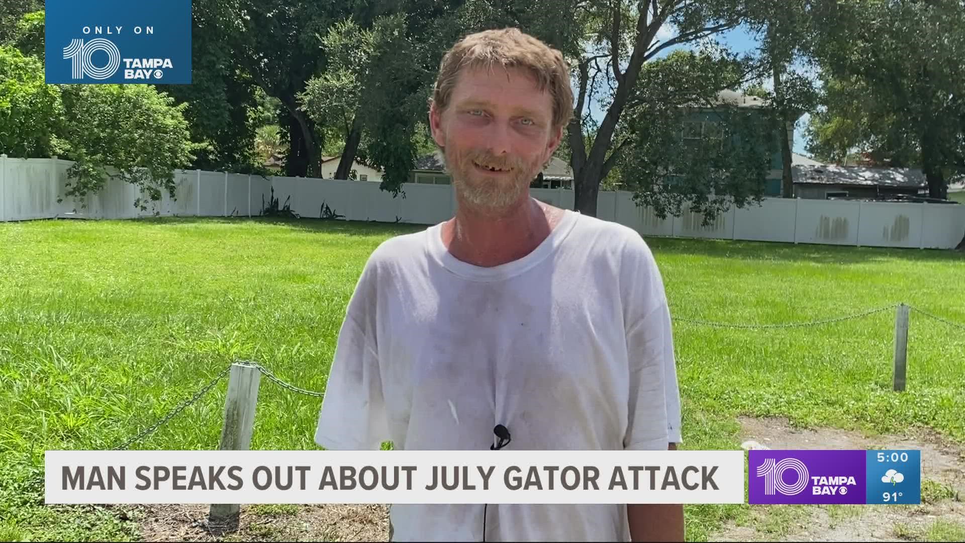Eric Merda says he was swimming in Lake Manatee when a gator bit his arm off. He said he survived three days in the swamp after the attack.